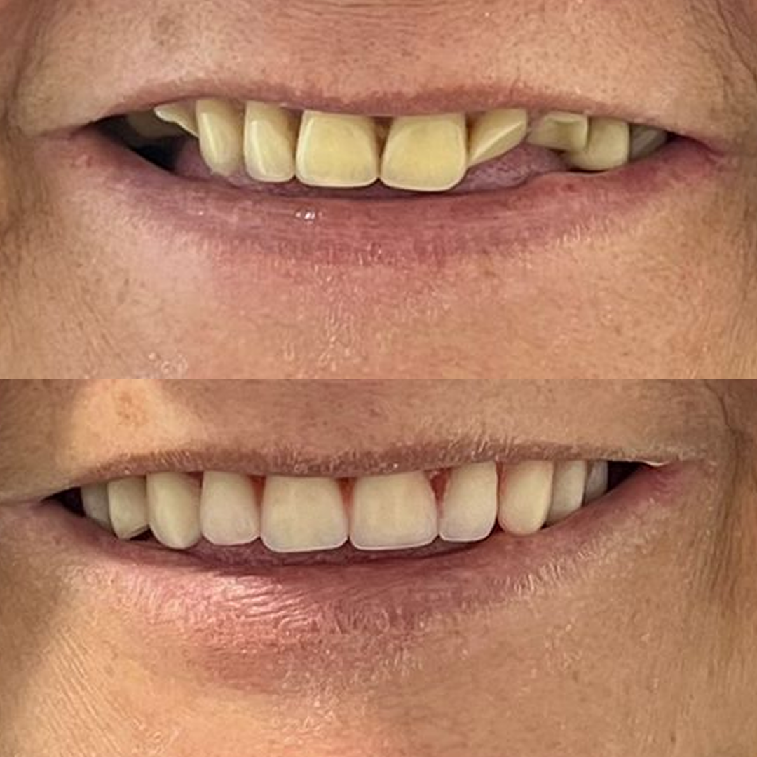 Odontocompany São Lourenço - Antes e Depois - 1v2