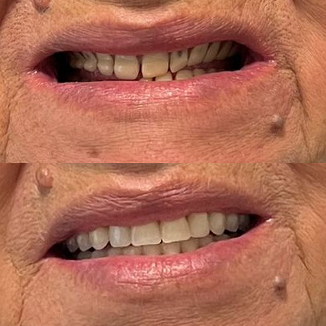 Odontocompany São Lourenço - Antes e Depois - 2v2