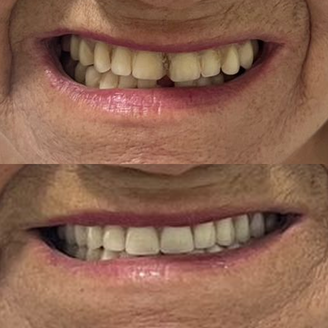 Odontocompany São Lourenço - Antes e Depois - 4v2